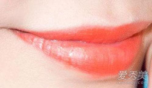 孕妇吃哈密瓜嘴唇过敏